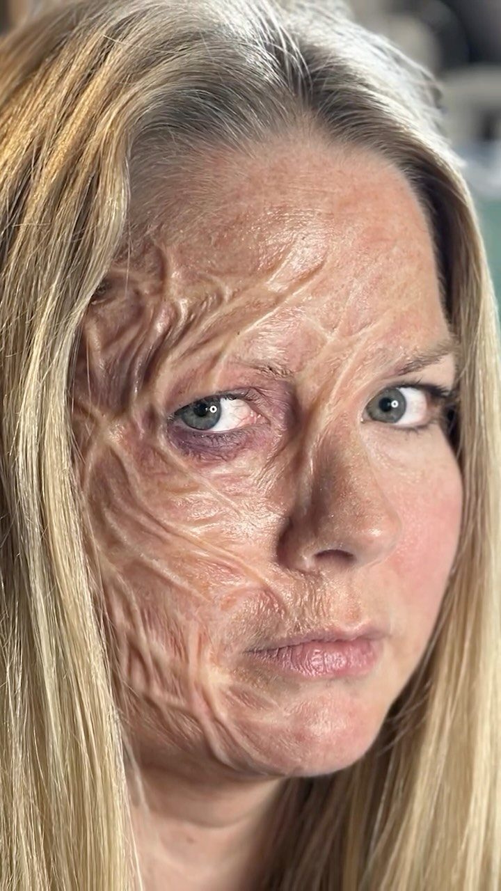 Woman with realistic burn and scar special effects makeup on half her face.